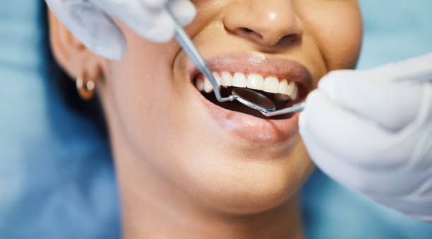 Best Emergency Dentist for Lost Fillings or Crowns in Montoursville, PA
